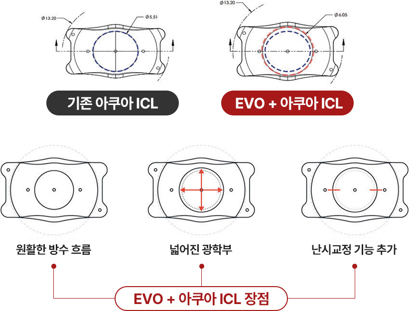 EVO + 아쿠아 ICL 장점 : 원활한 방수 흐름, 넓어진 광학부, 난시교정 기능 추가