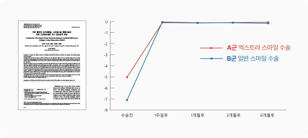 일반 스마일 수술과 엑스트라 스마일 수술 비교 차트